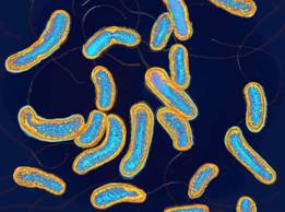 Vibrio cholerae, the bacteria that cause cholera, magnified a thousand times. If every disease is the result, in some way, of political and scientific choices, then why don’t we make better choices?